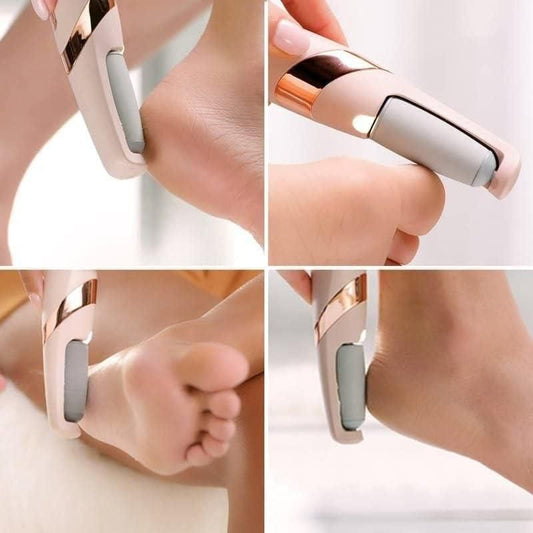 Electric Foot Callus Remover! 🦶✨